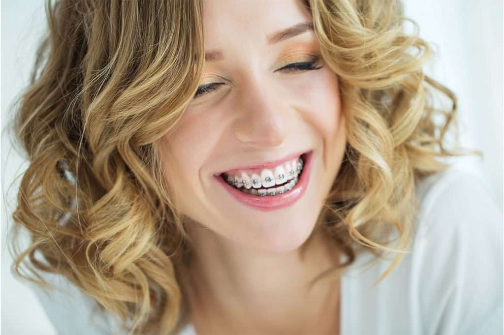 Teen girl with braces laughing in Canton, GA